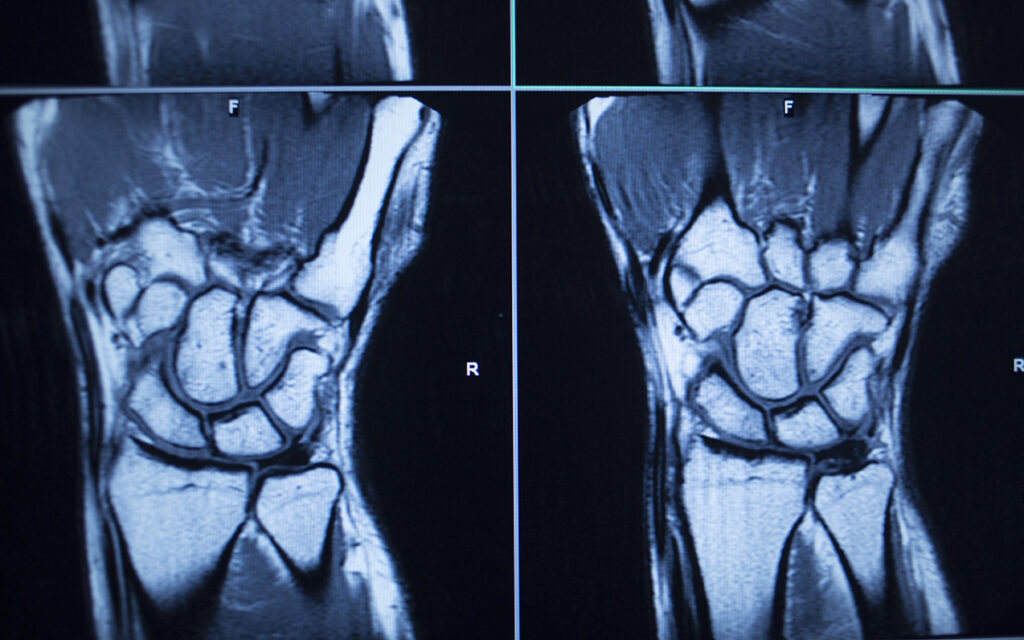 Medical Blogs Regarding Imaging | University Medical Imaging