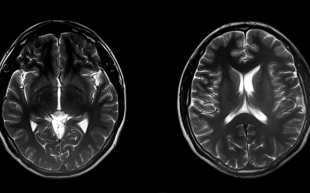Medical Blogs Regarding Imaging | University Medical Imaging