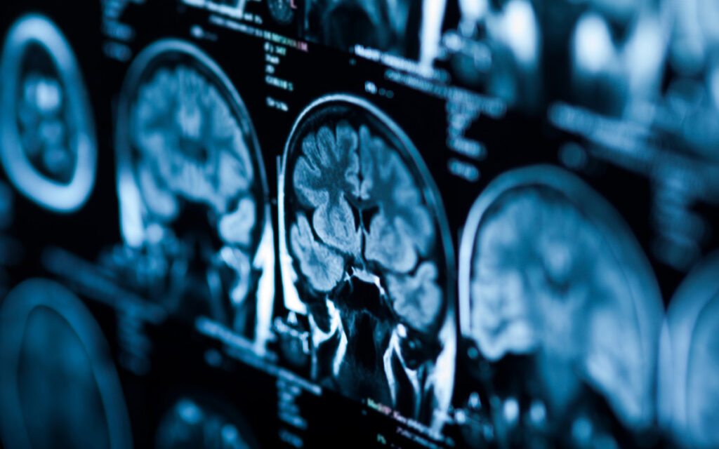 Medical Blogs Regarding Imaging | University Medical Imaging